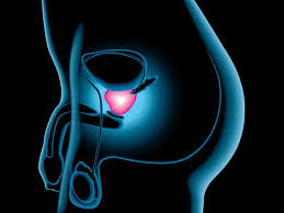 SIENTE EL PLACER AL MAXIMO CON NUESTRO MASAJE PROSTATICO