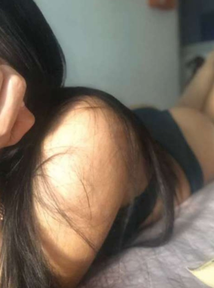 Scort