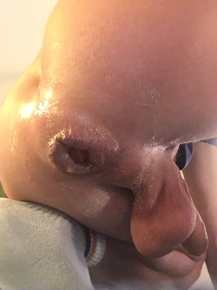 MASAJE BLANCO Y NEGRO A 4 MANOS