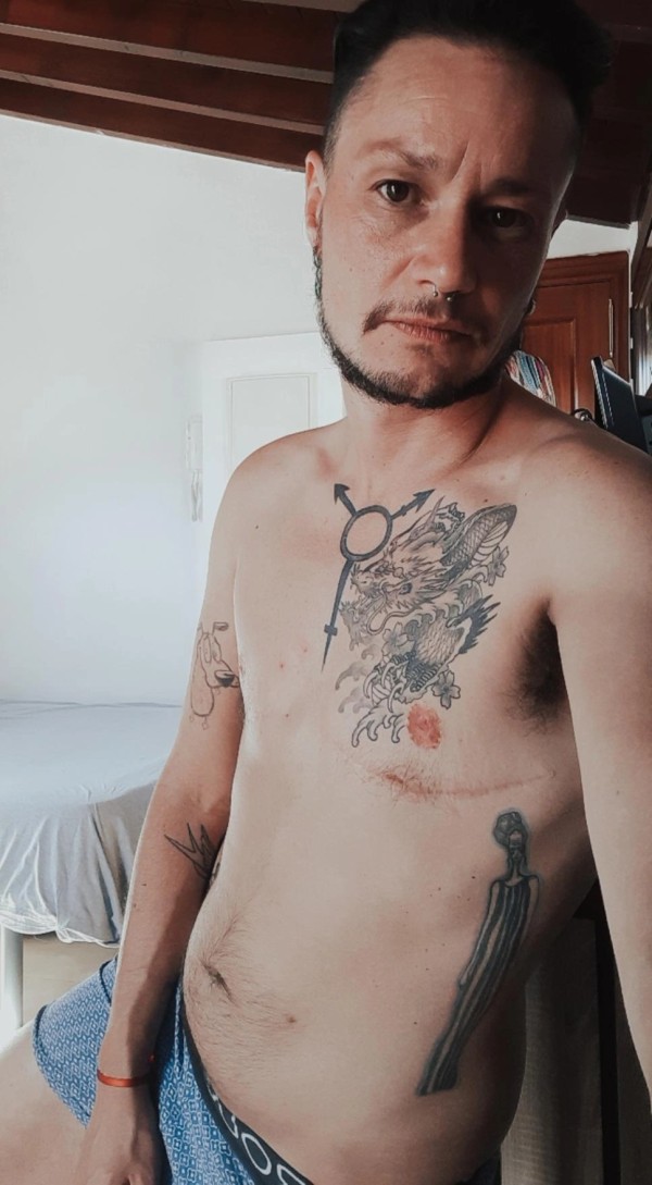 Varón trans (varón con vulva)