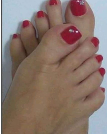 Madurita morbosa Hacepto Bizun