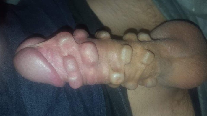 Pollia XXL 24 Perlas ++