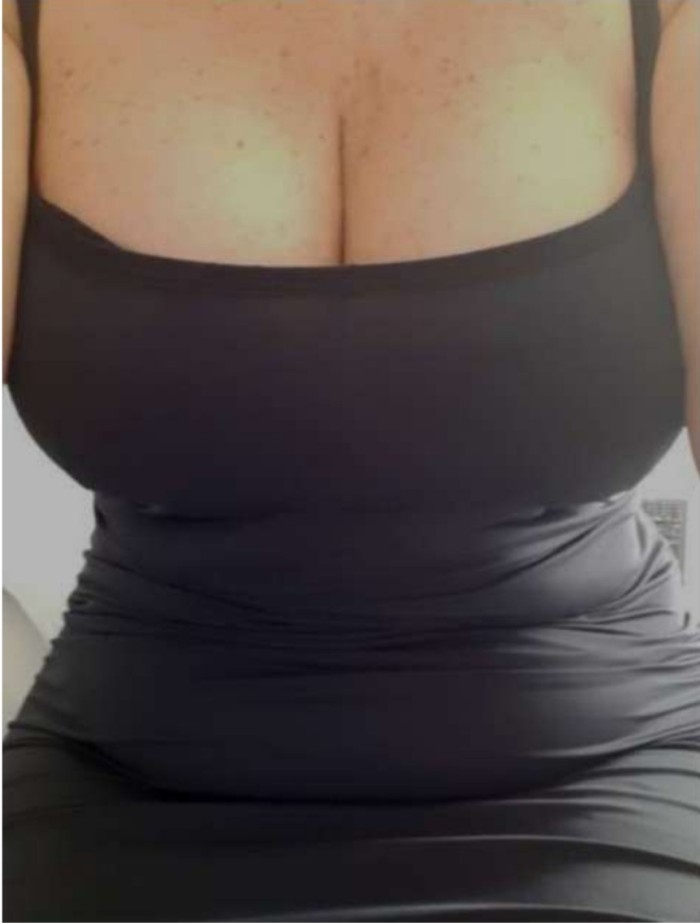 Benidorm,rubia madura,masaje prostático