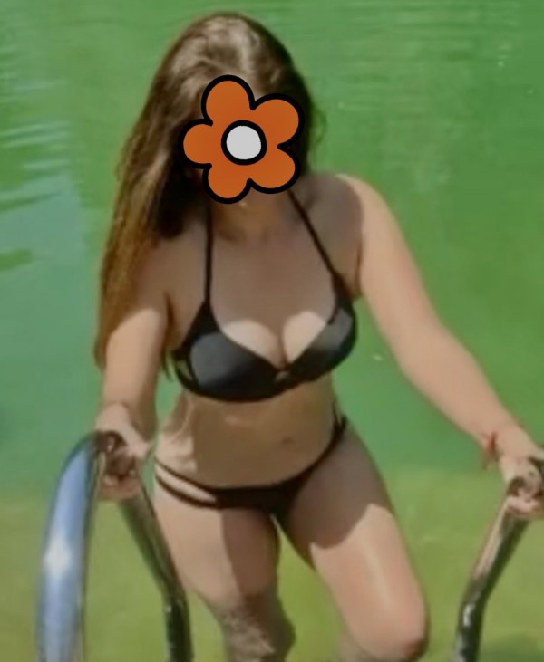 Vício en la piel morena