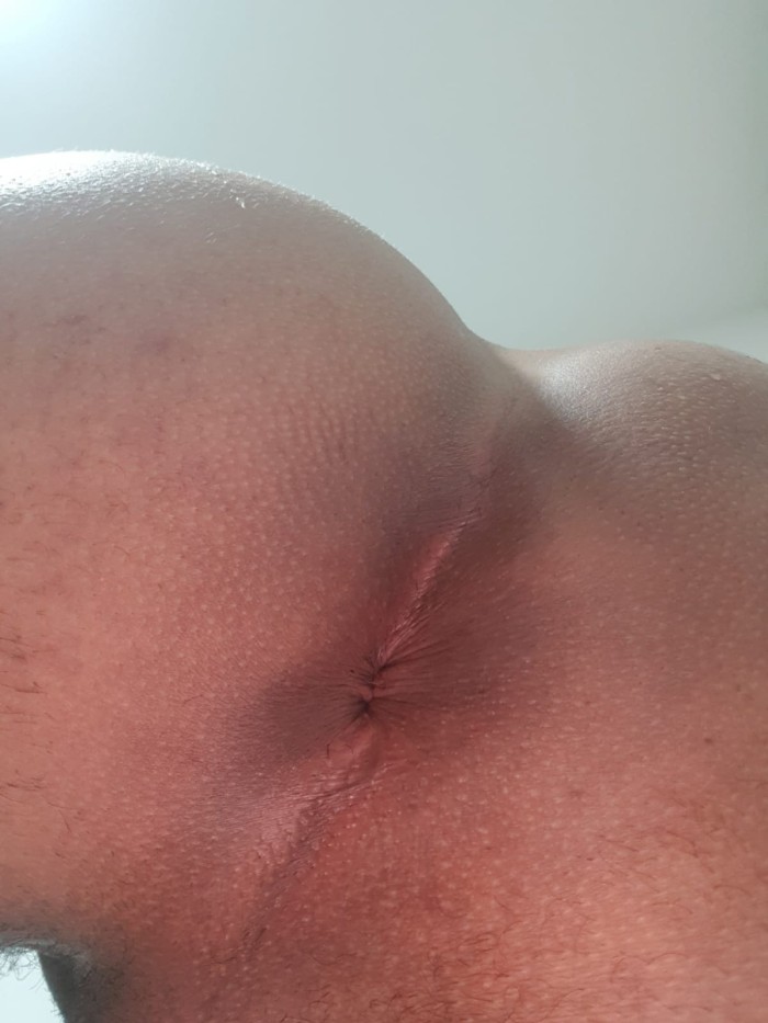 Supernovidad! Trans feminina( vitória?)