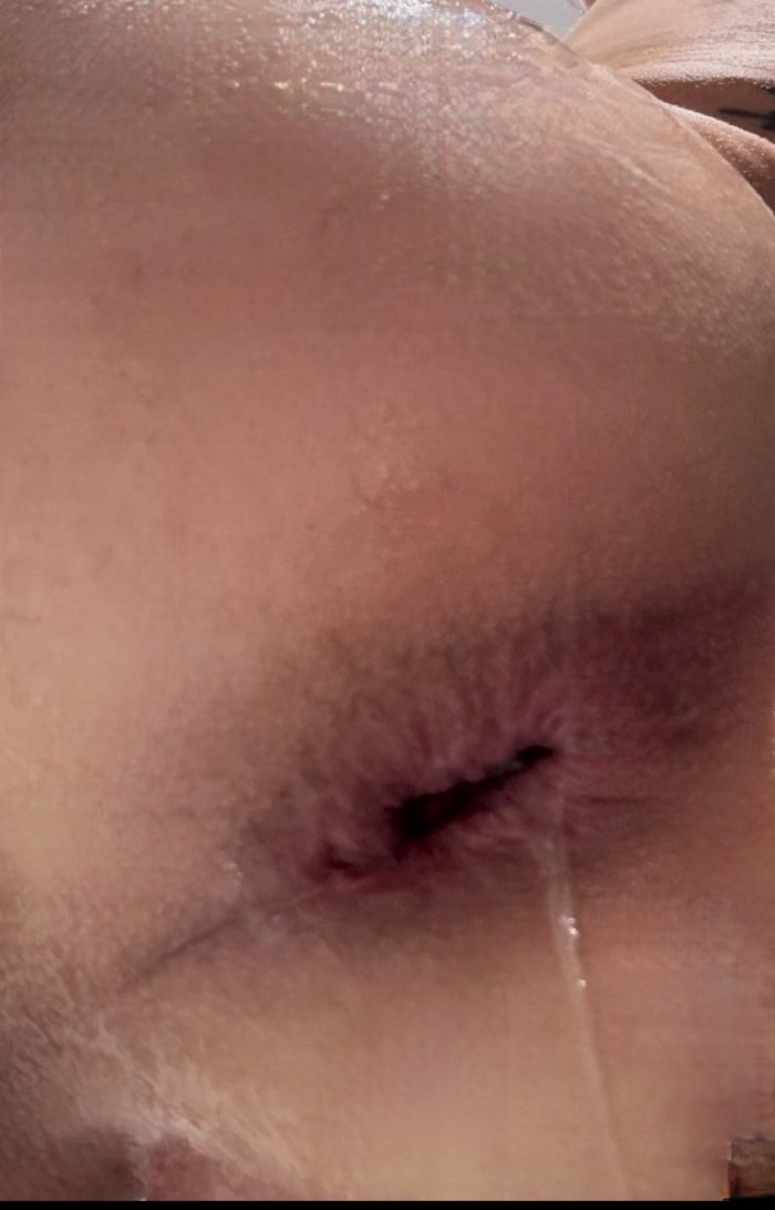 JUEGOS DILDOS DILATACION