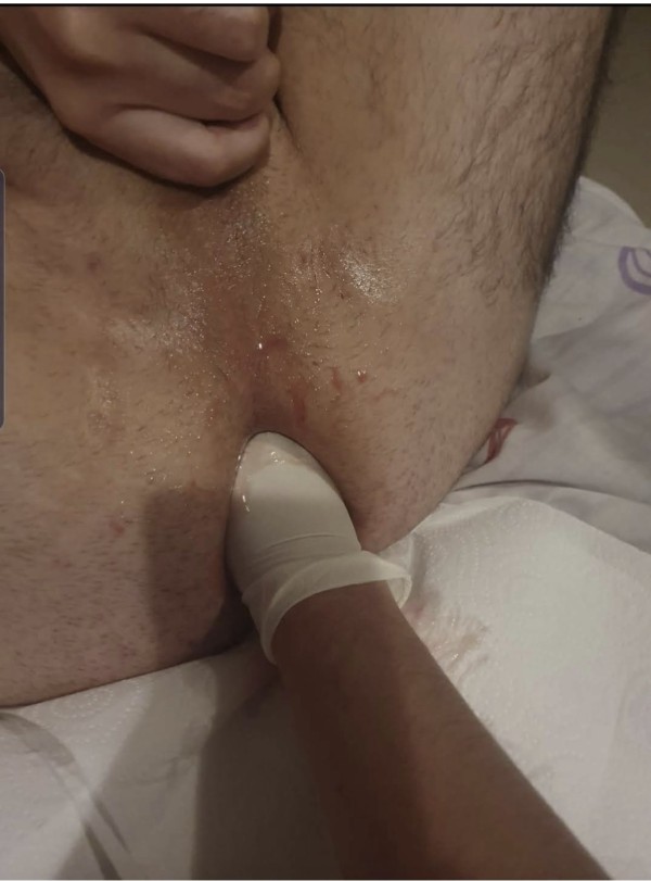 Masajes prostática con juguetes