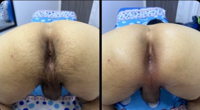 SERVICIO DE DEPILACIÓN CHICO 22AÑOS plaza Elíptica