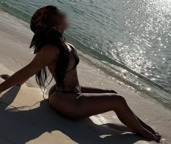 DESPLAZAMIENTOS 603 24 55 34  HOTELES Y DOMICILIOS INTENDENTE