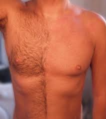 DEPILACIÓN SIN DOLOR ZONA GENITAL Y PERIANAL