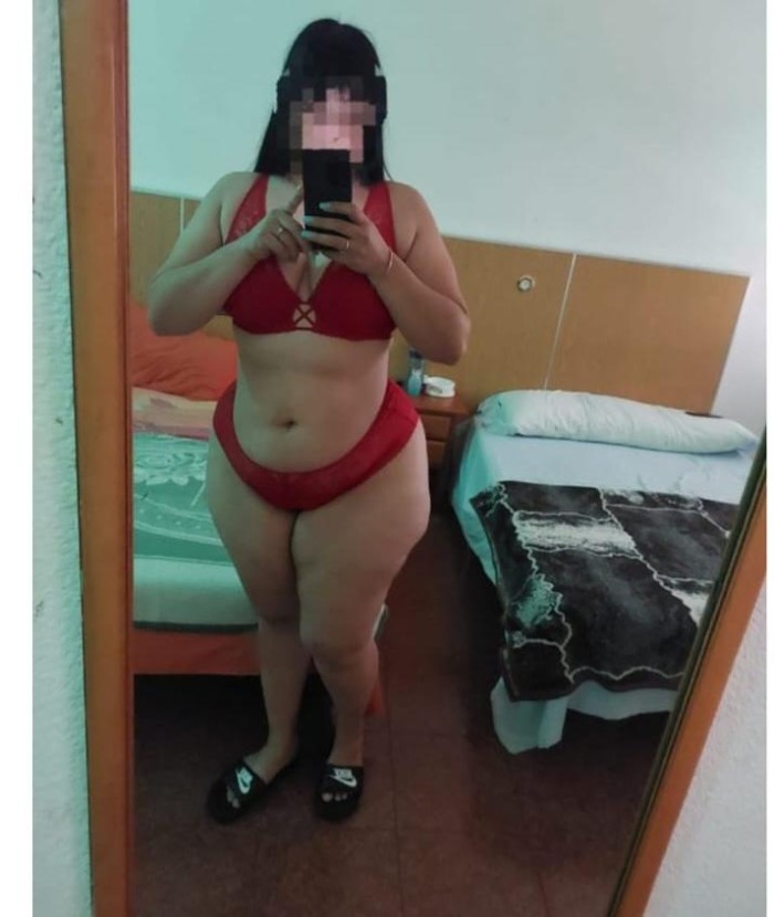 Curvas de infarto 24 horas