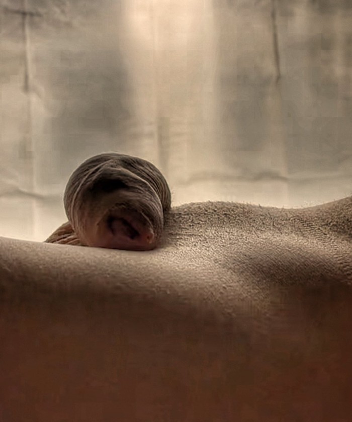 Dilatacion ANAL  PROSTATICO DATE PLACER ANAL