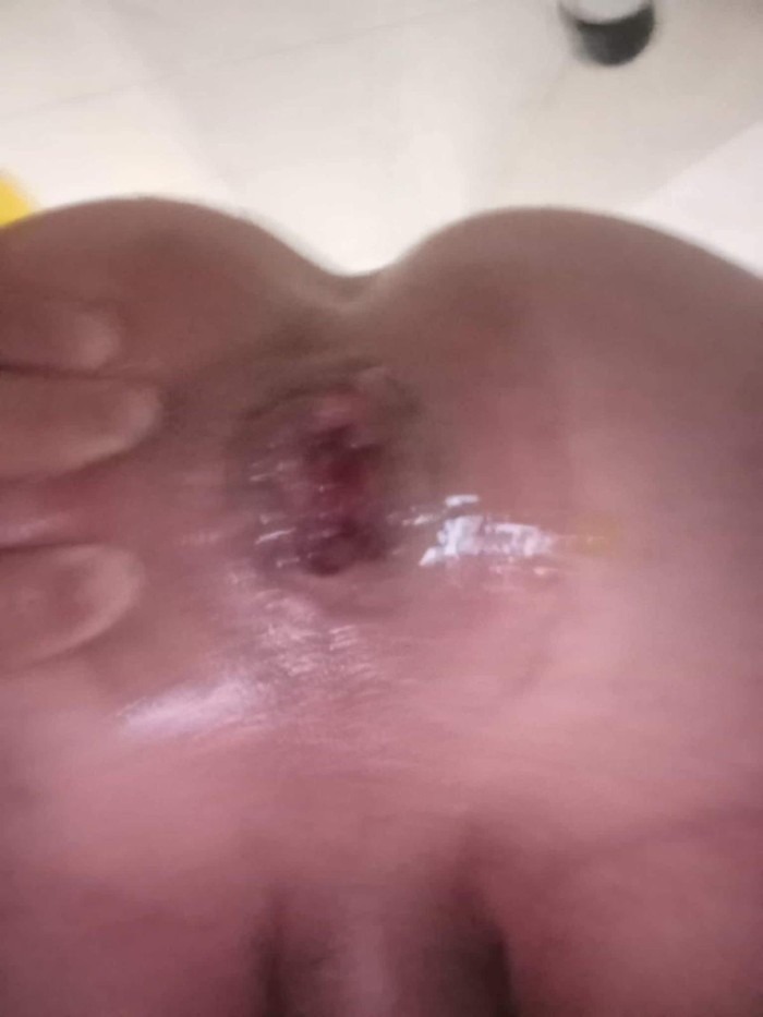 Garganta profunda fiesta bl tma morbo