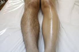 ESTETICA, MASAJES Y DEPILACIÓN GENITAL Y PERIANAL