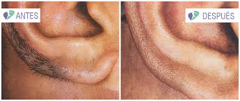 ESTETICA, MASAJES Y DEPILACIÓN GENITAL Y PERIANAL