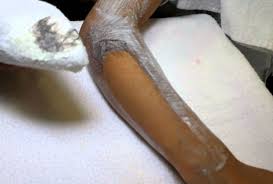 ESTETICA, MASAJES Y DEPILACIÓN GENITAL Y PERIANAL