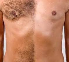 ESTETICA, MASAJES Y DEPILACIÓN GENITAL Y PERIANAL