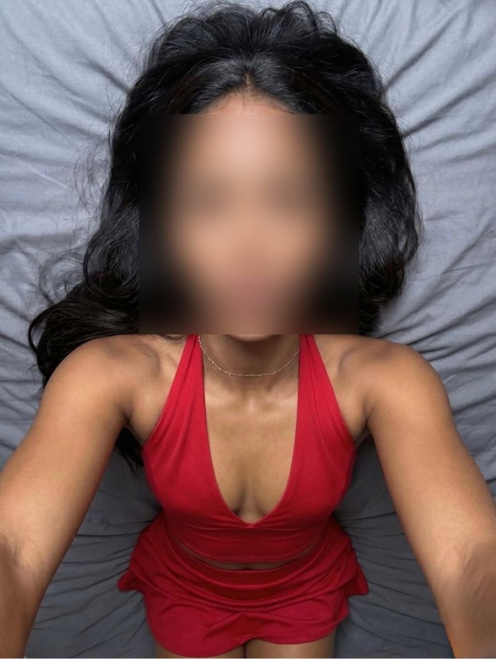 FLOR EXQUISITA VENEZOLANA ARDIENTE 24H