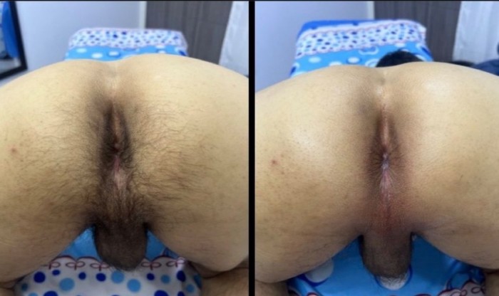 SERVICIO DE DEPILACIÓN con morbo Valdemoro