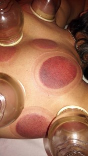 MASAJE CENTRO SAGRADA FAMILIA 931 892 478