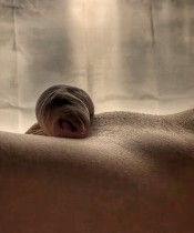 DILATACION ANAL  PROSTATICO DATE PLACER ANAL