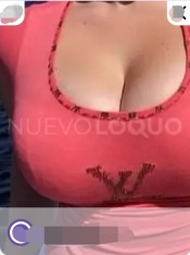 PLACER PROSTATICO ARNES